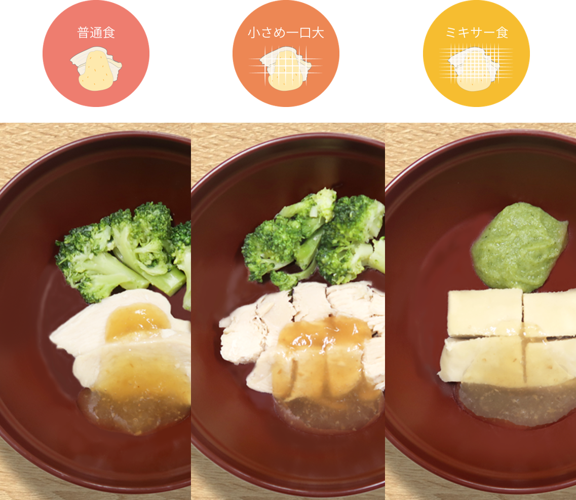 チーム医療_食事形態