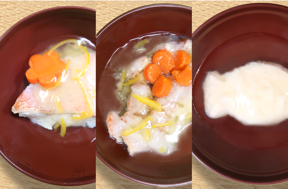 チーム医療_食事形態